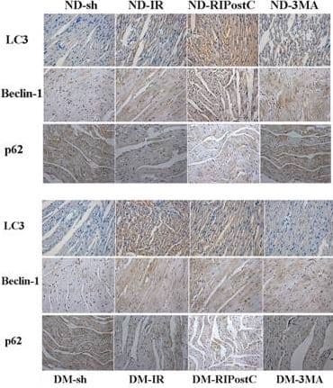 Anti-SQSTM1 / p62 antibody(AB91526)