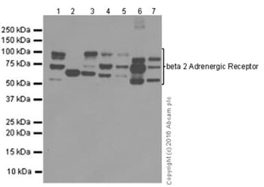 Anti-beta 2 Adrenergic Receptor antibody [EPR707(N)](AB182136)