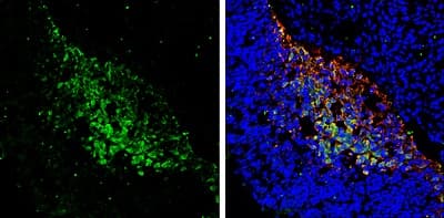 Anti-PGP9.5 antibody(AB227157)