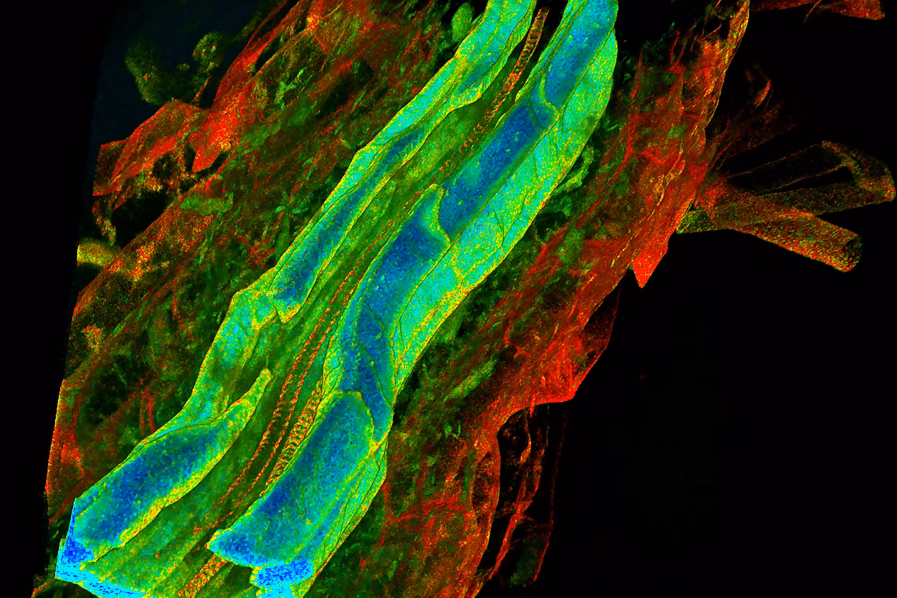 Endogenous Fluorescence Average Arrival Time Image Stellaris Kid21763585