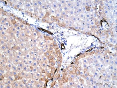 Anti-wide spectrum Cytokeratin antibody(AB9377)