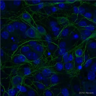 Anti-MAP2 antibody(AB92434)