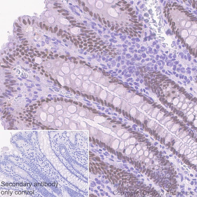 Hnf1 Alpha Antibody Rm1094 Bsa And Azide Free Ab316871  Immunohistochemistry Formalin Pfa Fixed Paraffin Embedded Sections Img428283