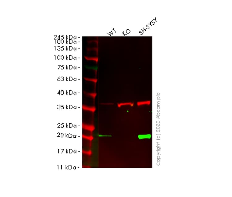 Anti-Ferritin heavy chain antibody [EPR3004Y](ab75973)