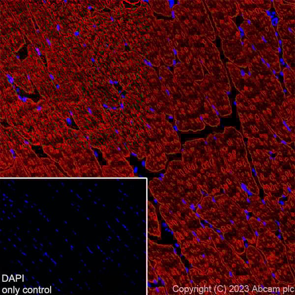 Alexa Fluor® 647 Anti-Myosin (MYH 1/2) antibody [A4.1025](AB315963)