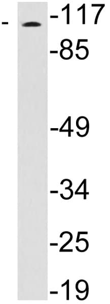 Wfs1 Antibody Ab230512  Western Blot Img142840