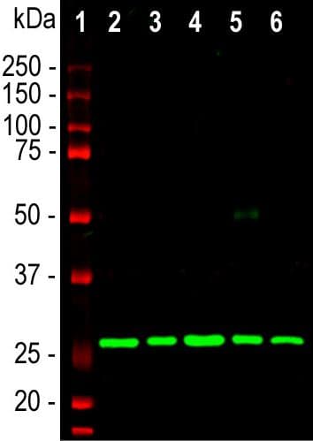 Anti-Calretinin antibody [6A9](AB277631)