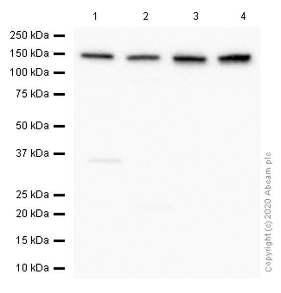 Anti-pan Cadherin antibody [EPR1792Y] - Intercellular Junction Marker(AB51034)