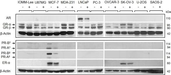 Anti-Androgen Receptor antibody [EP670Y](AB52615)