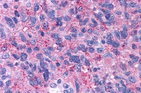 Anti-CRF1/CRHR1 antibody - N-terminal(AB230803)