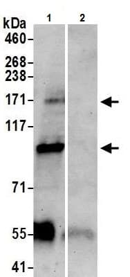Anti-TRPM2 antibody(AB11168)