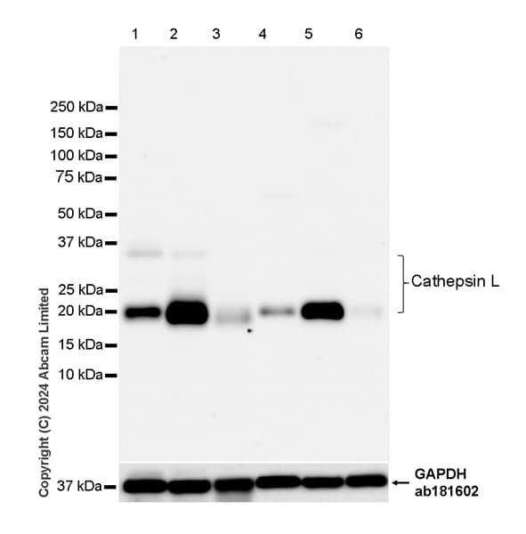 Anti-Cathepsin L/MEP antibody [EPR29413-573](AB321872)
