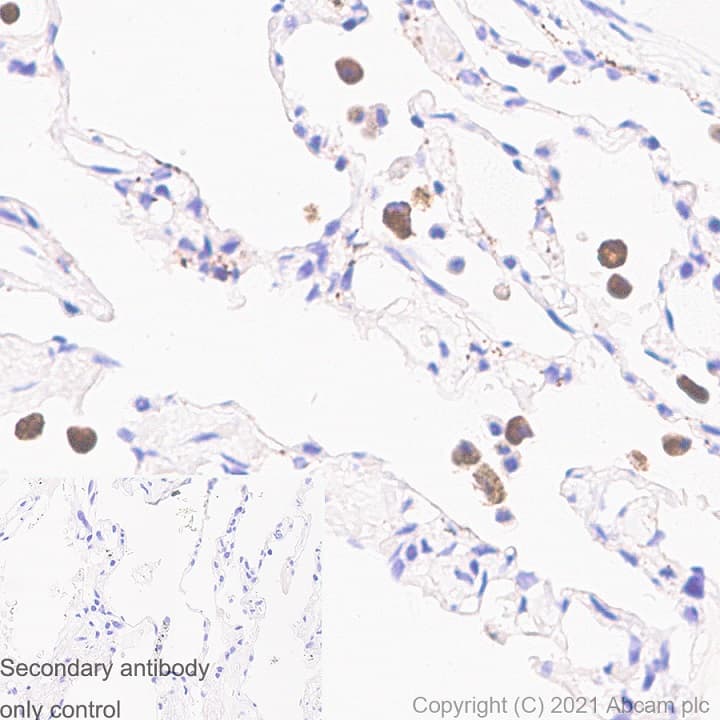Anti-iNOS antibody [RM1017](AB283655)