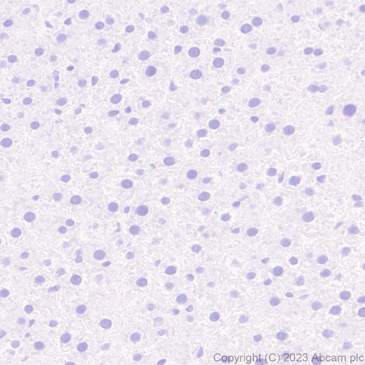 Anti-Homeobox protein cut-like 2 antibody [EPR26509-79](AB315796)