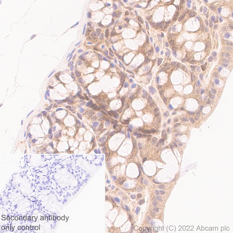 Smad2 Smad3 Antibody 18 Smad2 3 Bsa And Azide Free Ab305326  Immunohistochemistry Img406156