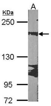 Rrbp1 Antibody Ab95983  Western Blot Img85307