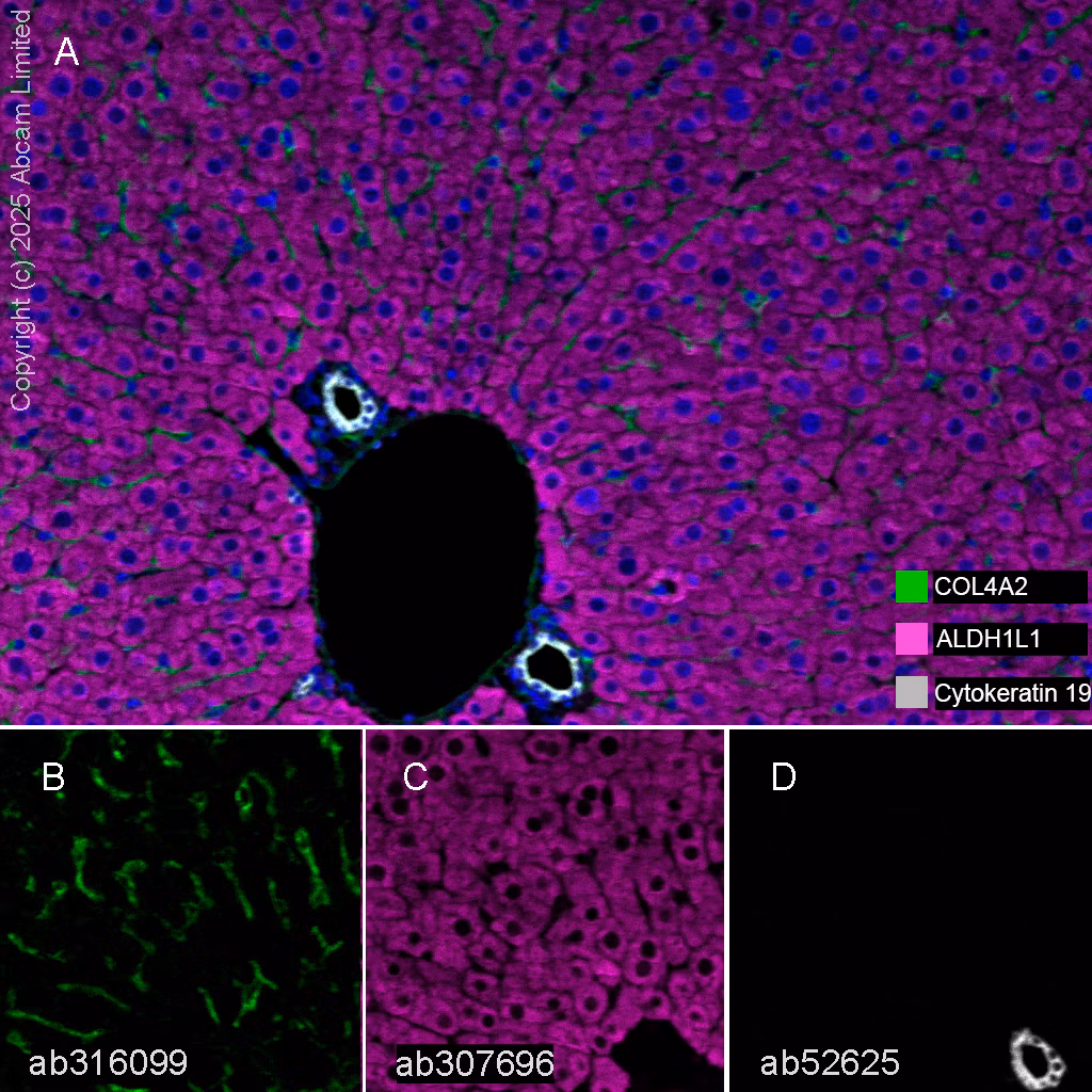 Cytokeratin 19 Antibody Ep1580y Cytoskeleton Marker Ab52625 Multiplex Immunohistochemistry Img447125