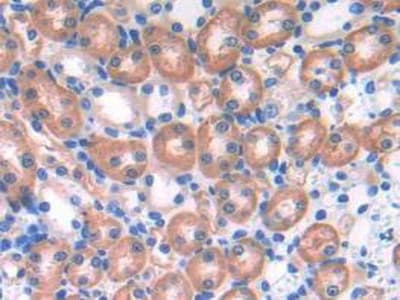 Ephrin A4 Antibody Ab232711  Immunohistochemistry Formalin Pfa Fixed Paraffin Embedded Sections Img97625