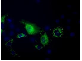 Pank2 Antibody Oti3h9 Ab119070  Immunocytochemistry Immunofluorescence Img50436