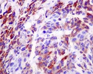 Nadk2 Antibody Epr13170 Ab181028  Immunohistochemistry Formalin Pfa Fixed Paraffin Embedded Sections Img105701