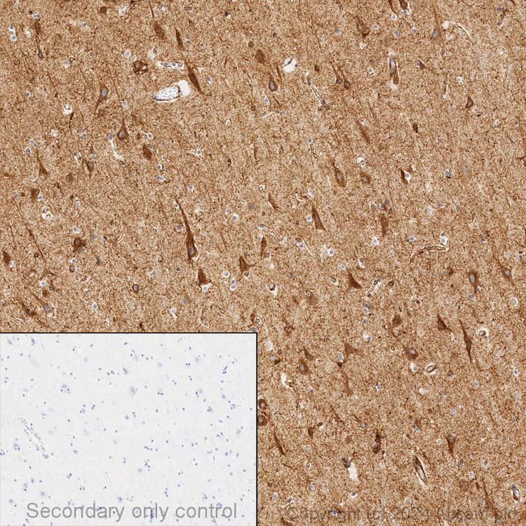 Anti-LRP1 antibody [EPR3724](AB92544)