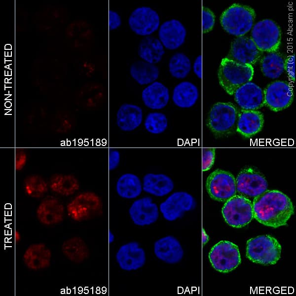 Alexa Fluor 647 Gamma H2ax Phospho S139 Antibody Ep8542y Ab195189  Immunocytochemistry Immunofluorescence Img98272
