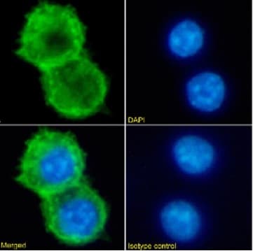 Anti-Alpha Gal antibody [m86] - Human IgM (Chimeric)(AB281899)