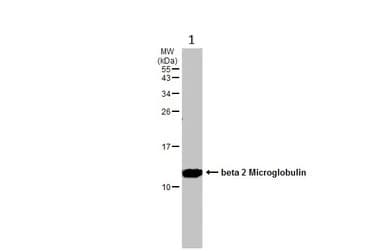 Beta 2 Microglobulin Antibody Ab227261  Western Blot Img450484
