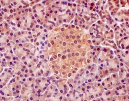 Anti-PHD finger protein 1/PHF1 antibody [EPR14222](AB184951)