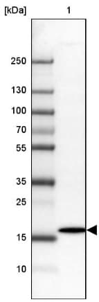Derlin 2 Antibody Ab185087  Western Blot Img38622