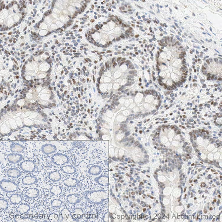 Anti-PMS2 antibody [EPR3947](AB110638)