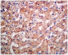 Ak3l1 Antibody Epr7678 Ab131327  Immunohistochemistry Formalin Pfa Fixed Paraffin Embedded Sections Img121139