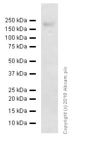Anti-ErbB2 / HER2 antibody [EP1045Y](AB134182)