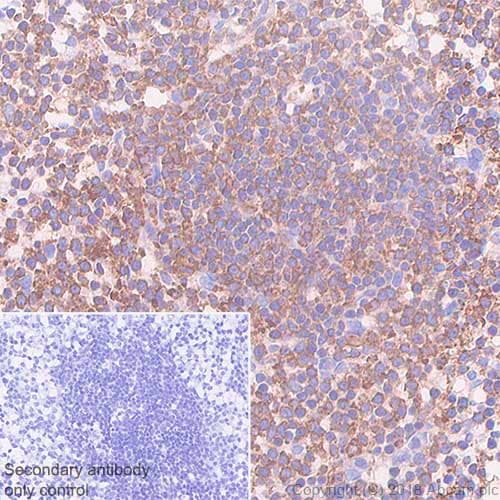 Vpac2 Antibody Sp235 Bsa And Azide Free Ab246352  Immunohistochemistry Formalin Pfa Fixed Paraffin Embedded Sections Img106598
