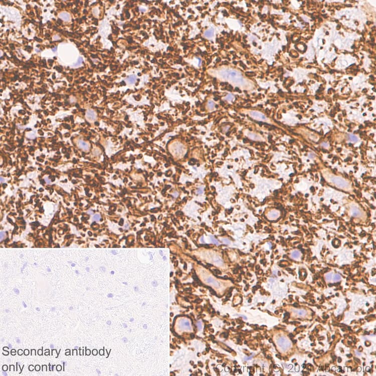 Anti-KCC2 antibody [EPR24203-85](AB259969)