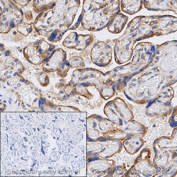 Anti-VEGF Receptor 1 antibody [Y103](AB32152)