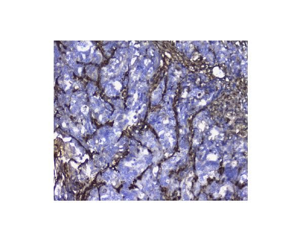 Galectin 1 Antibody Ab112525  Immunohistochemistry Formalin Pfa Fixed Paraffin Embedded Sections Img195