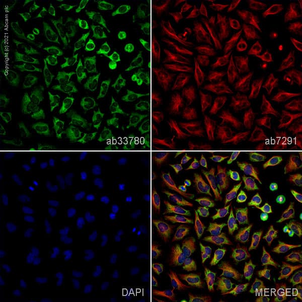 Anti-Glucose Transporter GLUT4 antibody(AB33780)