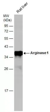 Anti-Liver Arginase antibody(AB96183)