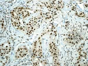 Sumo 1 Antibody Ep298 Bsa And Azide Free Ab248491  Immunohistochemistry Formalin Pfa Fixed Paraffin Embedded Sections Img111472