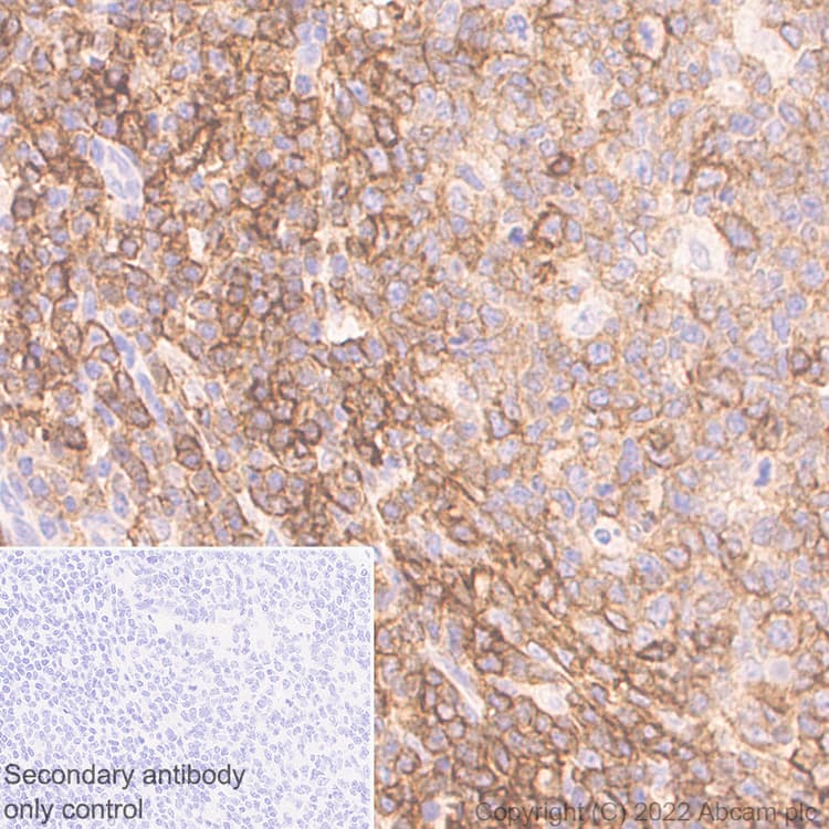 Semaphorin 4d Cd100 Antibody 30 Cd100 Ab307685  Immunohistochemistry Formalin Pfa Fixed Paraffin Embedded Sections Img408443