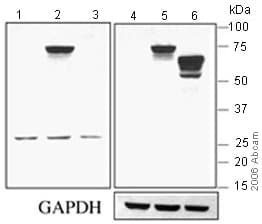 Anti-TBR2 / Eomes antibody(AB23345)