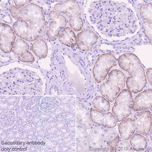 Anti-Glucose Transporter GLUT2 antibody [EPR22946-74](AB234440)