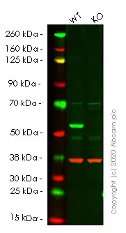 Anti-SQSTM1 / p62 antibody [EPR4844] - Autophagosome Marker(AB109012)