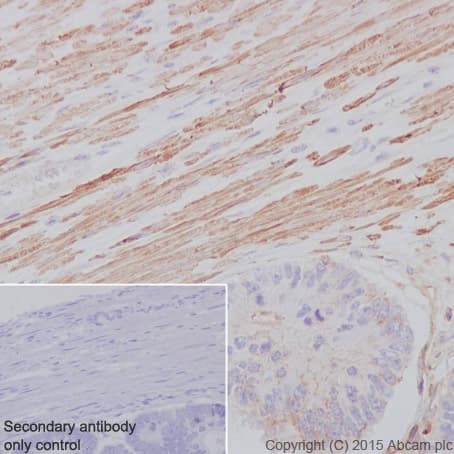 Anti-alpha smooth muscle Actin (acetyl E3) + ACTG2 (acetyl E3) antibody [E184](AB32575)