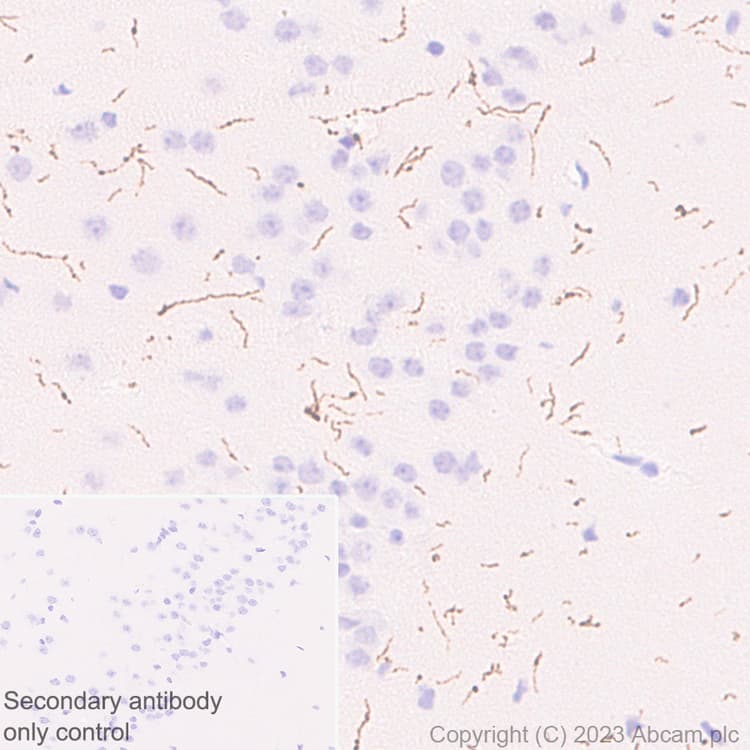 Anti-Tyrosine Hydroxylase antibody [RM1085](AB315252)