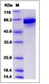 Recombinant mouse Transferrin protein (His tag)(ab276933)