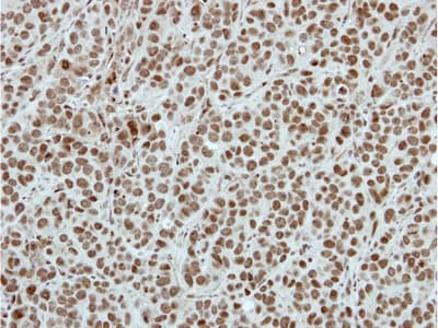 Sin3b Antibody Ab101841  Immunohistochemistry Formalin Pfa Fixed Paraffin Embedded Sections Img99669