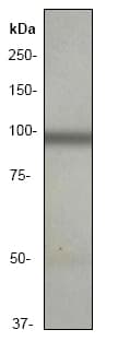 Glutamate Receptor 3 Glua3 Antibody Ep813y Ab40845  Western Blot Img157575