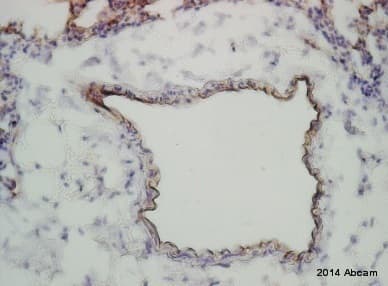 Anti-Claudin 5 antibody(AB15106)